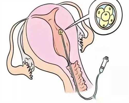 咨询试管供卵公司:无锡市妇幼保健院二代试管技术分析